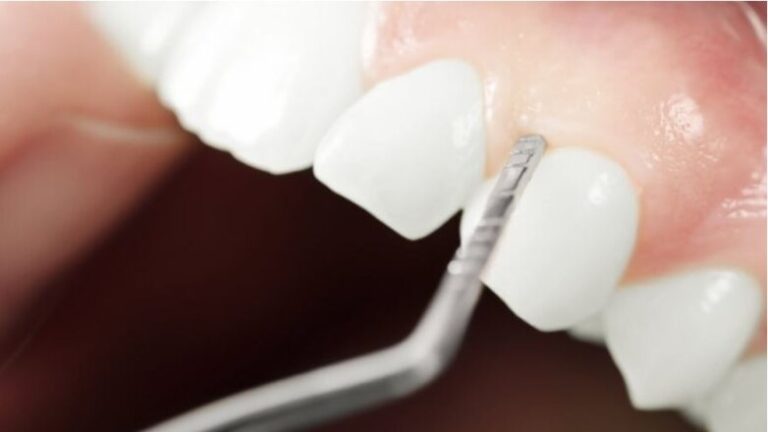 Η δημόσια οδοντιατρική δαπάνη στην Ελλάδα αγγίζει το… 0% ως ποσοστό της συνολικής οδοντιατρικής δαπάνης – Zougla