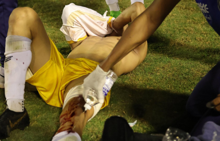 Τερματοφύλακας τραυματίστηκε από σφαίρα αστυνομικού σε σύρραξη παικτών στην Βραζιλία